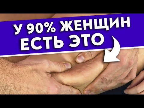 Видео: Как убрать обвисшую кожу передней поверхности бедра?