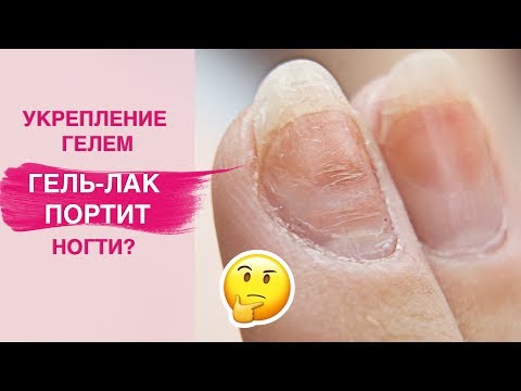 Видео: Спасаем ногти | УКРЕПЛЕНИЕ натуральных ногтей гелем