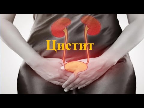 Видео: ЦИСТИТ - ҚУЫҚТЫҢ ҚАБЫНУ АУРУЫ