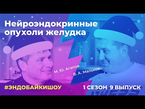 Видео: #ЭНДОБАЙКИШОУ. СЕЗОН 1, ВЫПУСК 9. НЕЙРОЭНДОКРИННЫЕ ОПУХОЛИ ЖЕЛУДКА.