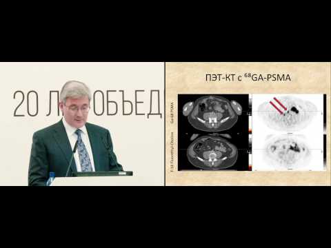 Видео: Биохимический рецидив при РПЖ: надо ли немедленно начинать лечение асимптомных больных