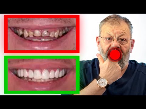 Видео: Здоровые зубы. 3 упражнения за 3 минуты в день!