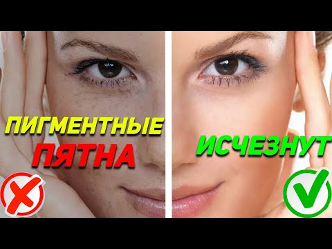 Видео: ПРИЧИНЫ ПИГМЕНТНЫХ ПЯТЕН И ИХ РЕШЕНИЕ / Психосоматика