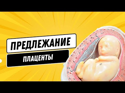 Видео: ПРЕДЛЕЖАНИЕ ПЛАЦЕНТЫ @DrOlenaB #беременность #предлежаниеплаценты #плацента