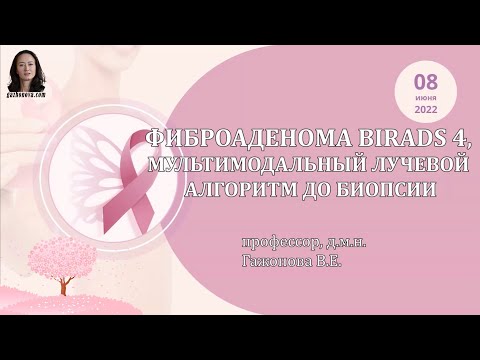 Видео: ФИБРОАДЕНОМА BIRADS 4, МУЛЬТИМОДАЛЬНЫЙ ЛУЧЕВОЙ АЛГОРИТМ ДО БИОПСИИ  Проф.  Гажонова В.Е.
