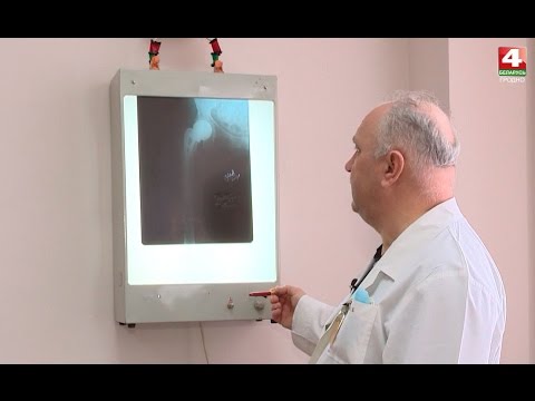 Видео: Вопрос здоровья. Перелом шейки бедра. 06.03.2017