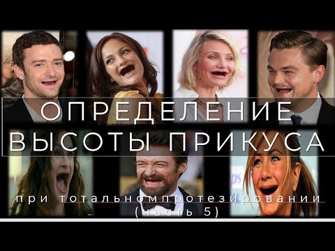 Видео: Тотальное Протезирование при Полной Адентии и Определение Высоты Прикуса