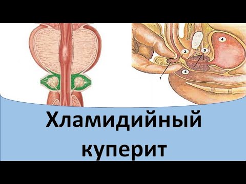 Видео: Хламидиоз куперовых желез.
