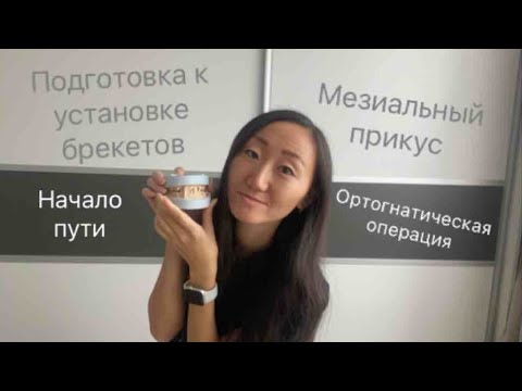 Видео: МОЯ ИСТОРИЯ НЕПРАВИЛЬНОГО ПРИКУСА🦷ПОДГОВОКА К УСТАНОВКЕ БРЕКЕТОВ😬 НАЧАЛО ПУТИ👌