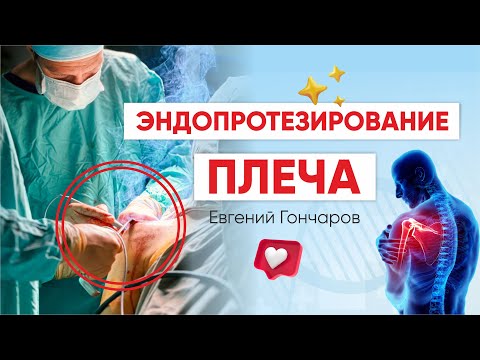 Видео: Все об эндопротезировании плеча: разбираемся с травматологом