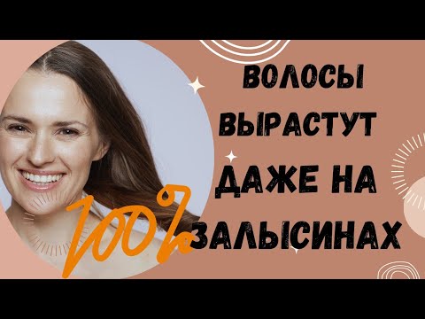 Видео: Эти маски рекомендуют даже после трансплантации волос!
