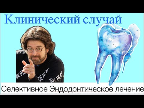 Видео: Редкий случай