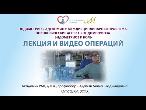 Видео: ЛЕКЦИЯ «ЭНДОМЕТРИОЗ, АДЕНОМИОЗ МЕЖДИСЦИПЛИНАРНАЯ ПРОБЛЕМА  ОНКОЛОГИЧЕСКИЕ АСПЕКТЫ ЭНДОМЕТ