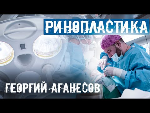 Видео: ГЕОРГИЙ АГАНЕСОВ ПРО РИНОПЛАСТИКУ. ВОПРОСЫ И ОТВЕТЫ.