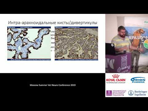 Видео: Копытов К. Г. - Кистозные мальформации ЗЧЯ