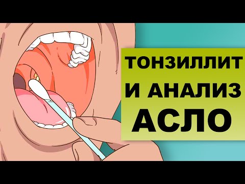 Видео: АНАЛИЗ АСЛО ПРИ ТОНЗИЛЛИТЕ