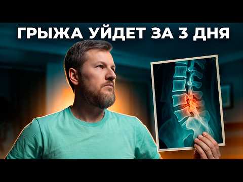 Видео: Грыжа в спине – как убрать без операции