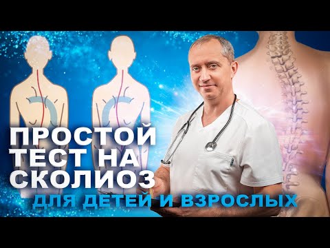 Видео: Простой тест на сколиоз для детей и взрослых
