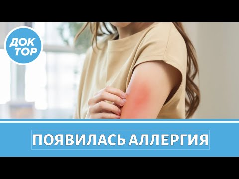 Видео: Врач–иммунолог про неочевидные причины аллергии