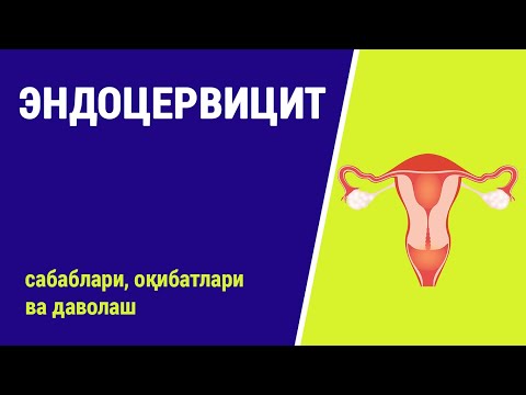 Видео: Эндоцервицит: сабаблари, оқибатлари ва даволаш