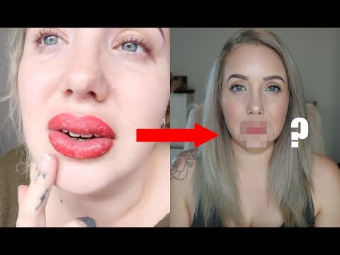 Видео: Мои губы — год спустя