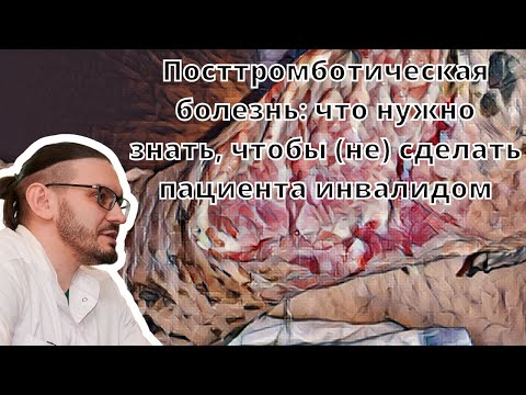 Видео: Видеолекция "Посттромботическая болезнь: что нужно знать, чтобы не сделать пациента инвалидом"