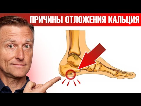 Видео: Главные причины отложения кальция в теле 🧐