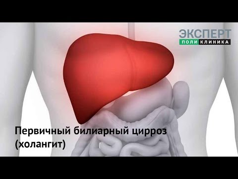 Видео: Первичный билиарный цирроз (холангит)