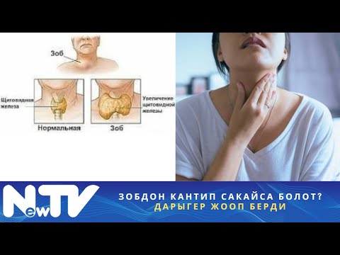 Видео: Зобдон кантип сакайса болот? Дарыгер жооп берди