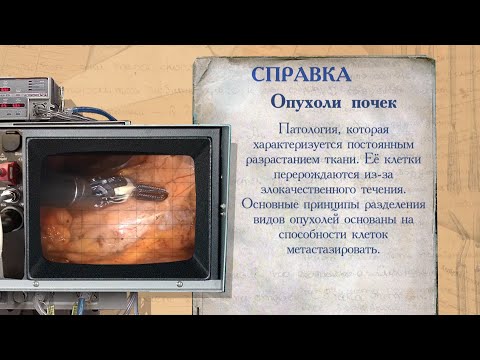 Видео: «История болезни». Рак почки