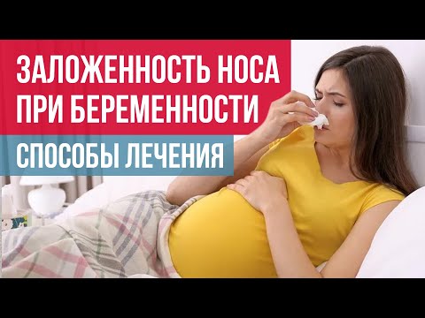Видео: Заложенность носа при беременности: симптомы и лечение ринита беременных