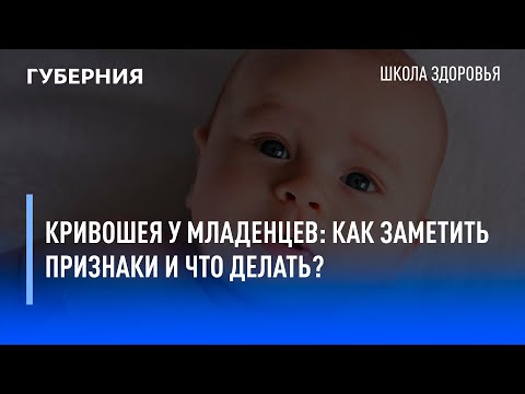 Видео: Кривошея у младенцев: как заметить признаки и что делать? Школа здоровья. GuberniaTV