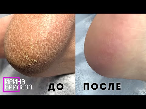 Видео: СЕКРЕТ идеального педикюра 🌸 ЧТО и КАК???