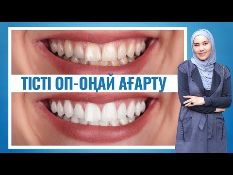 Видео: Үй жағдайында тісті ағарту оңай жолдары Мика Ханым