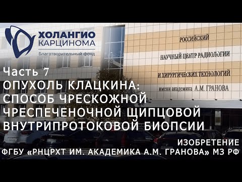 Видео: ЧАСТЬ 7. ОПУХОЛЬ КЛАЦКИНА: СПОСОБ БИОПСИИ. ИЗОБРЕТЕНИЕ ФГБУ «РНЦРХТ ИМ.АКАДЕМИКА А.М. ГРАНОВА» МЗ РФ