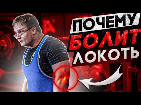 Видео: БОЛЬ в  ЛОКТЕВОМ СУСТАВЕ | Эпикондилит, Тендинит, Артроз | Причины, Диагностика, Лечение