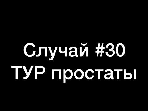 Видео: TUR prostate/ ТУР простаты. Case/Случай #30.