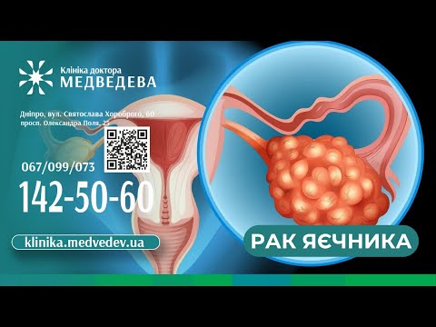 Видео: Про рак яєчника