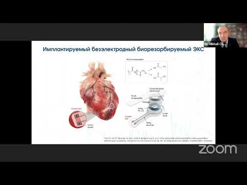 Видео: Новые методы и перспективы физиологической электрокардистимуляции