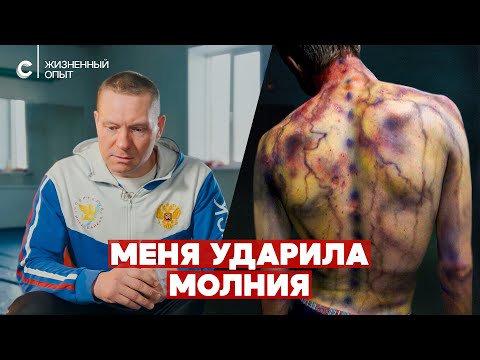 Видео: «Был вход через голову, выход через ногу». Пережил удар молнии