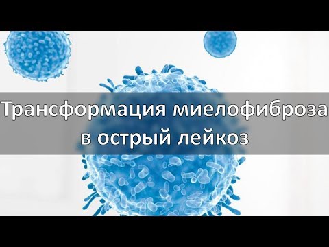 Видео: Трансформация миелофиброза в острый лейкоз