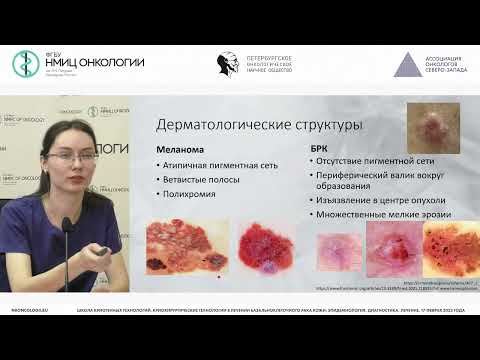 Видео: Роль дерматоскопии в диагностике базальноклеточного рака кожи