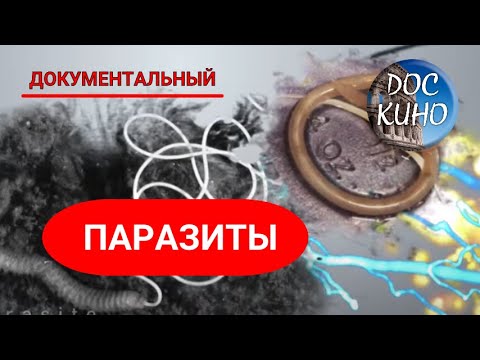 Видео: 🎭ПАРАЗИТЫ 🌎 ДОКУМЕНТАЛЬНОЕ КИНО 🎆 2014