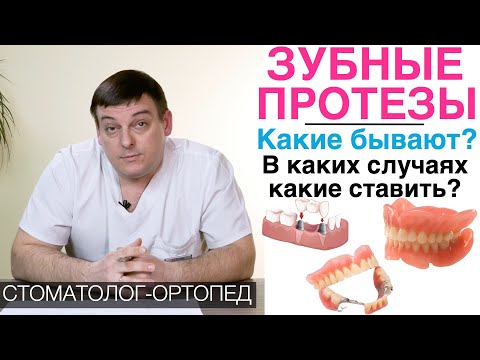 Видео: Какие зубные протезы ставить? Бюгельный зубной протез, зубной мост, частично-съемный зубной протез.