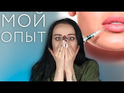 Видео: ГУБЫ: МОЙ ОПЫТ УВЕЛИЧЕНИЯ