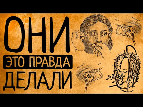 Видео: Самые дикие бьюти-процедуры прошлого, на которые отваживались женщины!