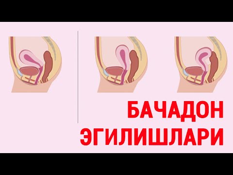 Видео: Бачадон жойлашуви. Эгилишлари. Уларнинг аҳамияти. #doctorYakubjonov