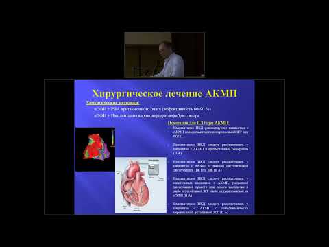 Видео: Аритмогенная дисплазия правого желудочка/аритмогенная кардиомиопатия