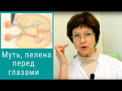 Видео: Муть в глазах, пелена перед глазами - что это значит и что делать?