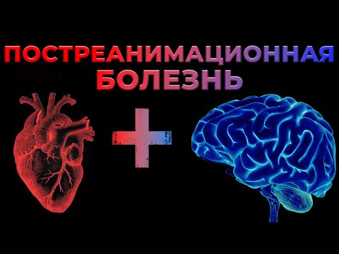 Видео: Постреанимационная болезнь. Что делать после успешной реанимации и восстановления ритма сердца?